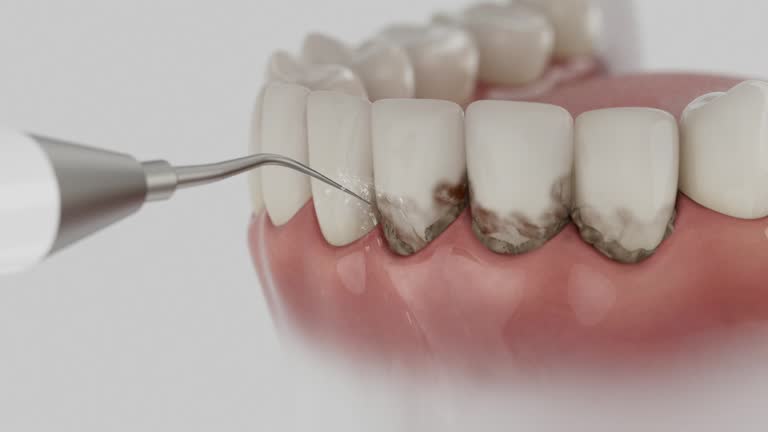 Reliable Emergency Dentist contractor in Lancaster, TX by Smile Center Dentistry